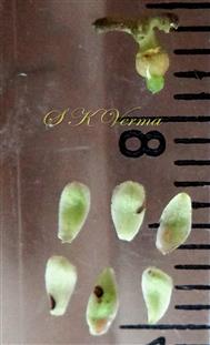   Parts of female flower-Pistil and Perianth